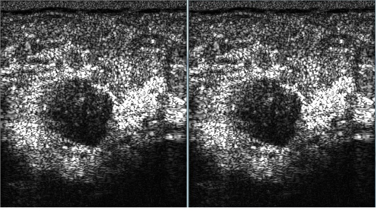 Comparison chart ultrasound Modern Digital